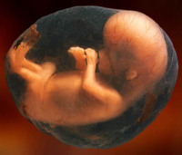 8-week-unborn-baby.jpg